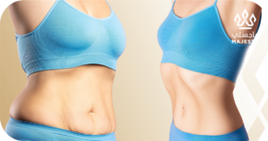 نتائج شد البطن الكامل والمصغر