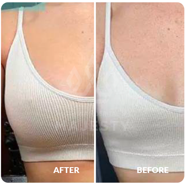 تكبير الصدر