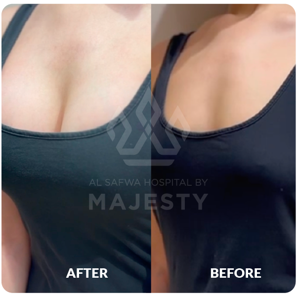 تكبير الصدر