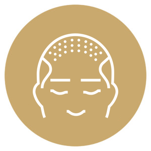 زراعة الشعر بأحدث التقنيات