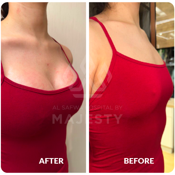 تكبير الصدر