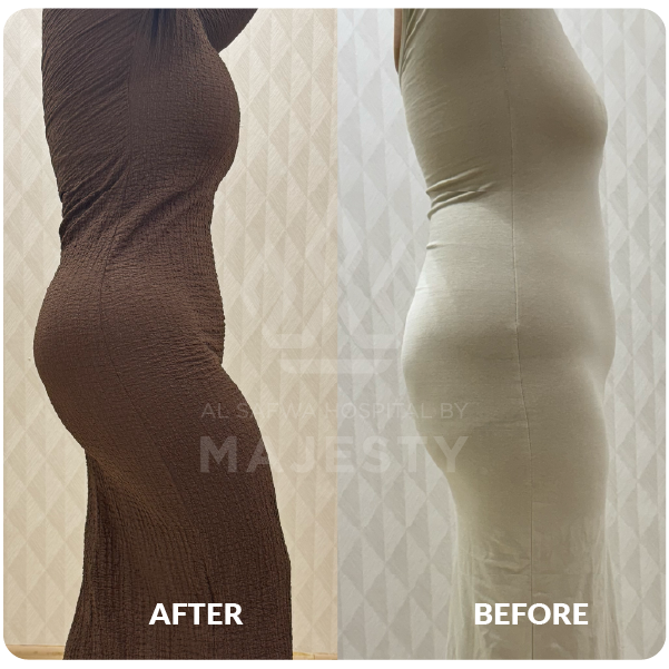 شد بطن وصدر