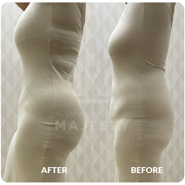 شد بطن وصدر