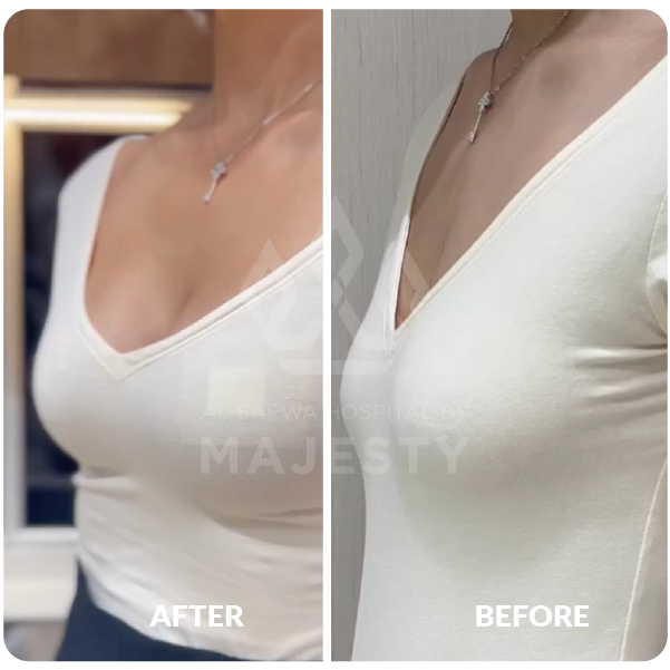 تكبير الصدر