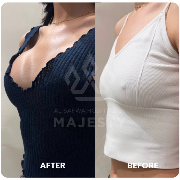 تكبير الصدر