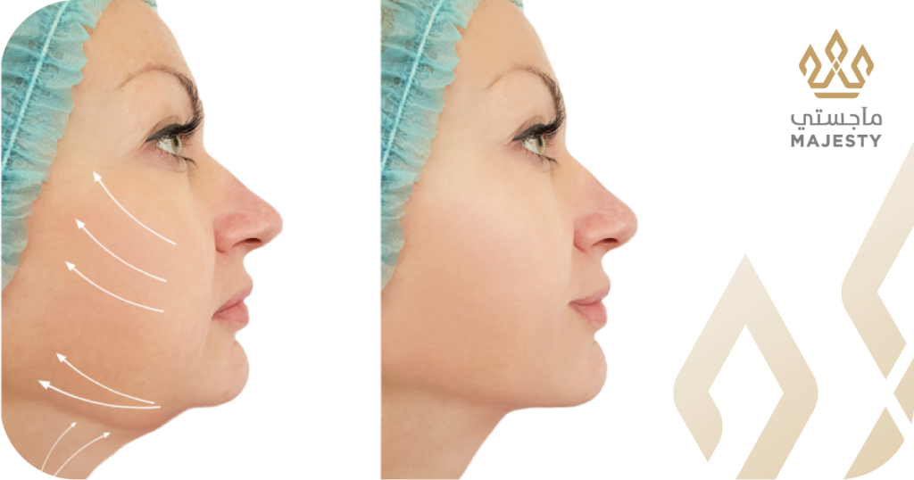 مراحل التعافي بعد عملية شفط اللغلوغ: دليلك يوماً بيوم