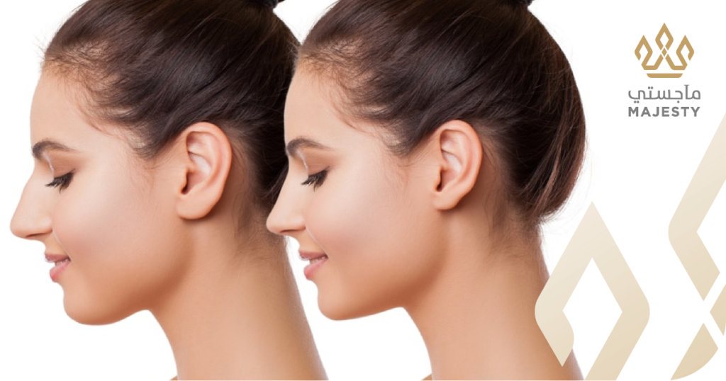 عملية تجميل الأذن البارزة في الرياض: دليلك للثقة والمظهر المتناسق (2026)