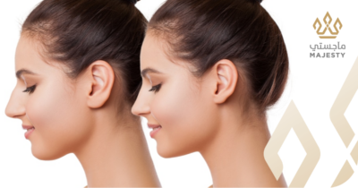 عملية تجميل الأذن البارزة في الرياض: دليلك للثقة والمظهر المتناسق (2026)