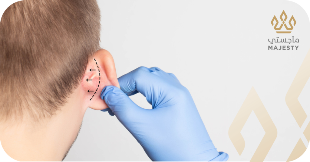 مرحلة التعافي بعد عملية تجميل الأذن البارزة: دليلك من اليوم الأول حتى الشفاء التام