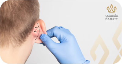 مرحلة التعافي بعد عملية تجميل الأذن البارزة: دليلك من اليوم الأول حتى الشفاء التام