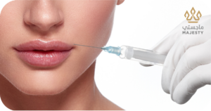 فيلر الشفايف