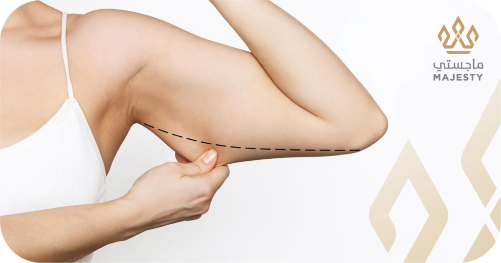 تكلفة عملية شد الذراعين في الرياض 2026: القائمة الكاملة