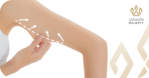 تكلفة عملية شد الذراعين