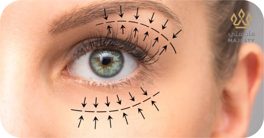 عملية قص الجفون في الرياض: تخلصي من “النظرة المتعبة” نهائياً