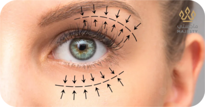 عملية قص الجفون في الرياض: تخلصي من “النظرة المتعبة” نهائياً