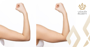 أفضل دكتور تجميل جفون في الرياض