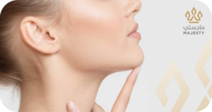 بعد شهر – وضوح تحديد الفك