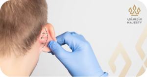 نتائج عملية تجميل الأذن